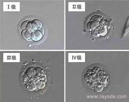 试管婴儿胚胎等级怎么划分？