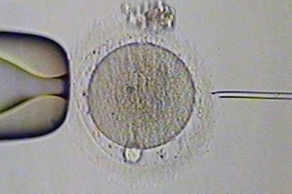 武威口碑最好代怀哪家_武威代怀生子多少钱_泰国试管婴儿基因检测对囊胚有伤