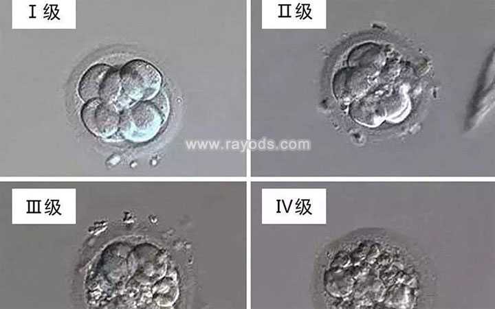 南昌代怀孩子联系方式_南昌代怀生子网_二代试管培养的胚胎质量怎么样？等级